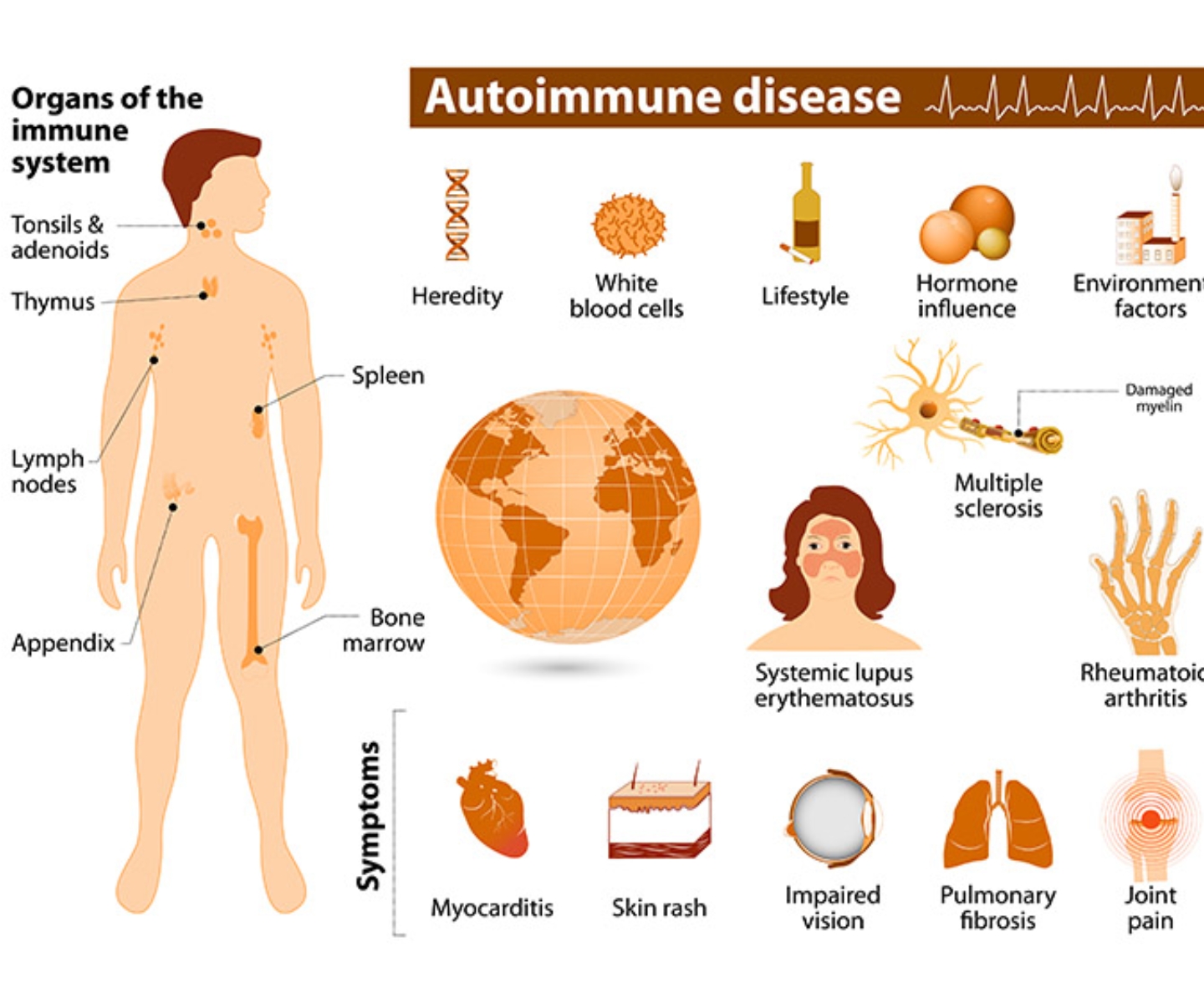 Autoimmune Disorder